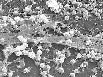   Staphylococcus aureus.  CDC/ Rodney M. Donlan, Ph.D.; Janice Carr (PHIL #7488), 2005