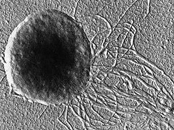 ��������� Methanococcus jannaschii. ������ �� �������� ���������� �� �������� ����������� ����������. ���� � ����� bioinfo.bact.wisc.edu