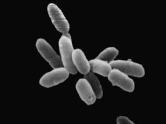 ������ ����� �� ������ Halobacteria. ���� NASA